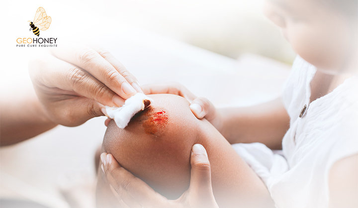 Comparison Of The Antibacterial Activity Of Honey From Different Provenance Against Bacteria Usually Isolated From Skin Wounds